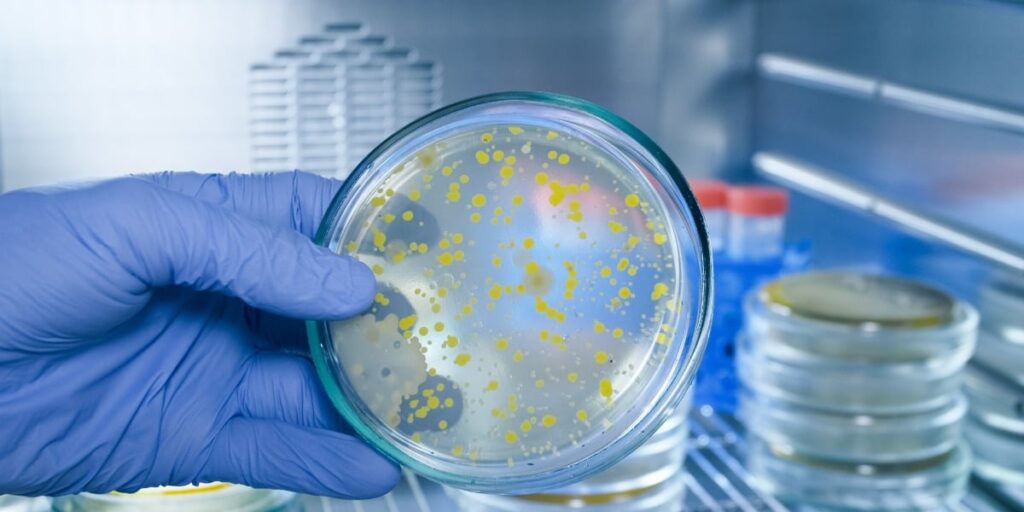 Bacteria Testing Still Belongs at the Core of Water Quality Work